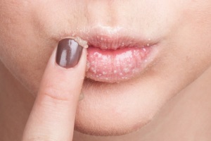 Zuerst müssen Sie sich richtig auf das Auftragen des matten Lippenstifts vorbereiten: